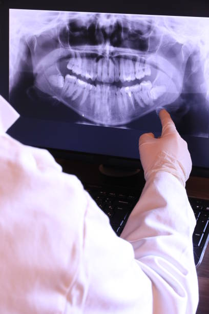Best Emergency Root Canal Treatment in New Haven, MI
