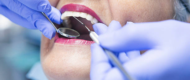 Best Same-Day Emergency Dental Services in New Haven, MI